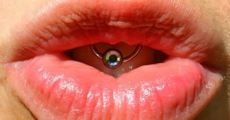 Czy kolczyk w języku niszczy zęby? Poznaj ryzyko i skutki zdrowotne