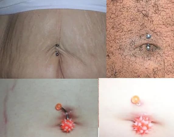 Kolczyk w pępku objawy zakażenia – nie ignoruj tych sygnałów